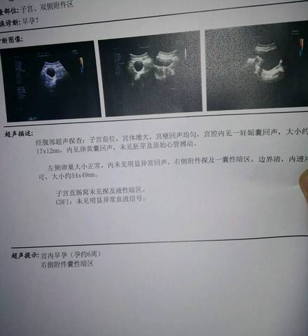 journal_insert_pic_825995895