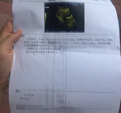 journal_insert_pic_829352291