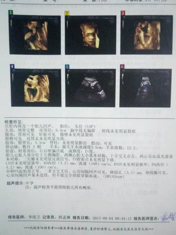 journal_insert_pic_831910303