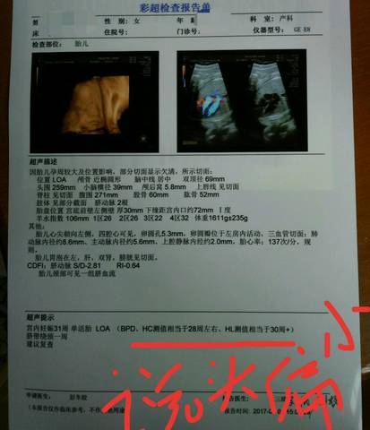 journal_insert_pic_833335889
