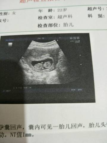 journal_insert_pic_833521644