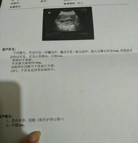 journal_insert_pic_833521674