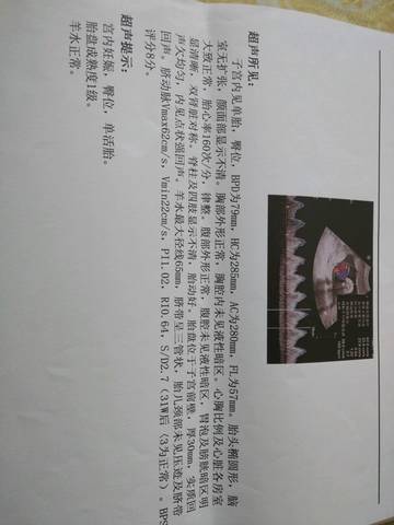 journal_insert_pic_833593595