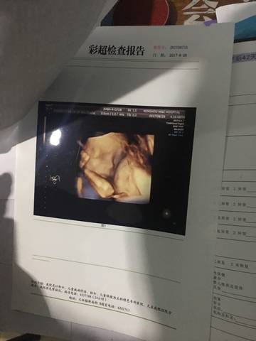 journal_insert_pic_833739870