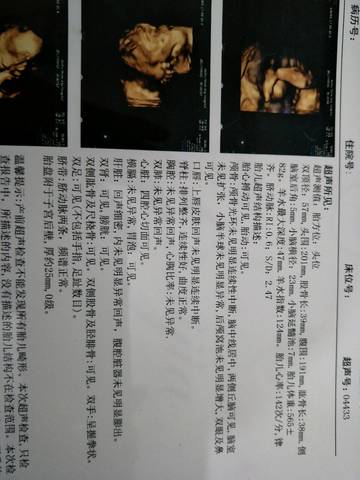 journal_insert_pic_833994280