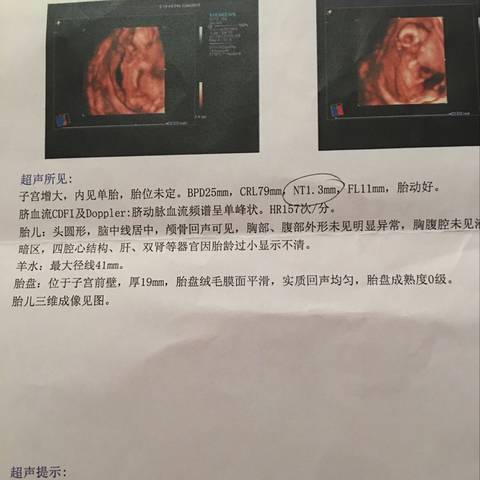 journal_insert_pic_834887953