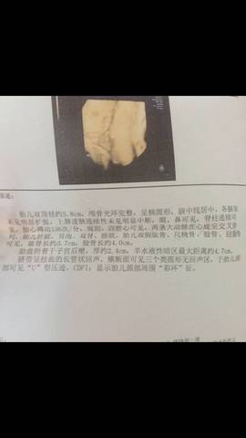 journal_insert_pic_834978658