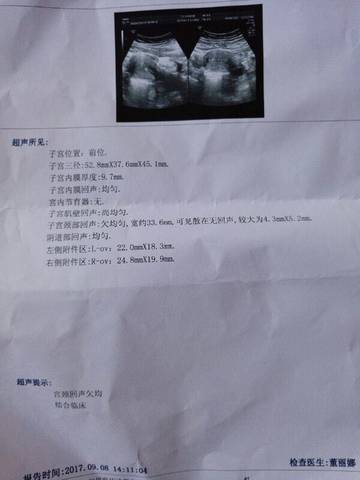 journal_insert_pic_835180561