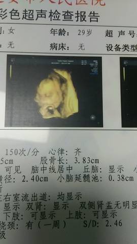 journal_insert_pic_838545148