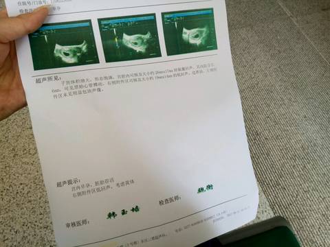 journal_insert_pic_838504032