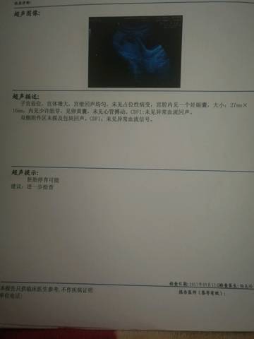 journal_insert_pic_839230751