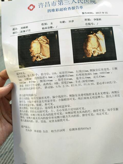 许昌四维彩超