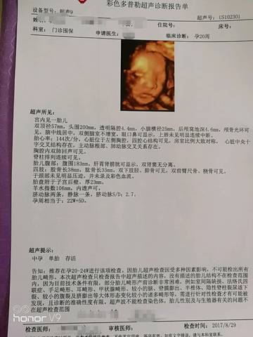 journal_insert_pic_842361373