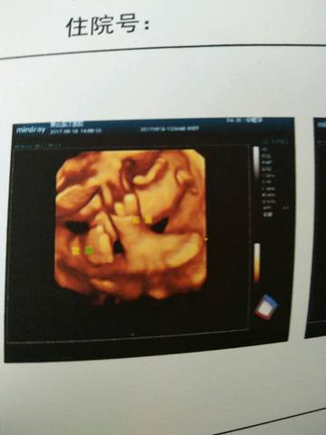 journal_insert_pic_843205881