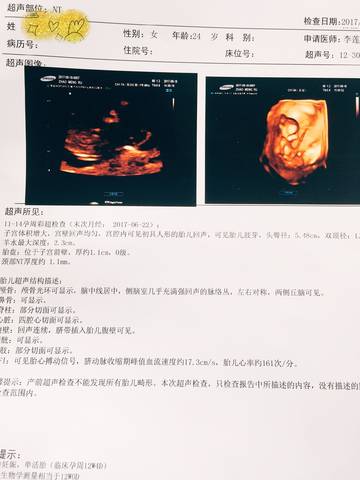 journal_insert_pic_844592468