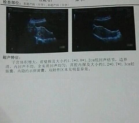 journal_insert_pic_847135951