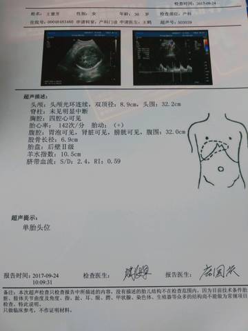 journal_insert_pic_846633646