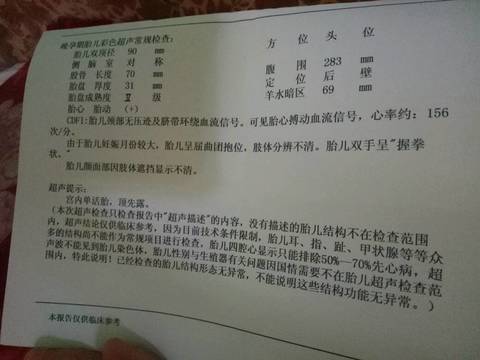 journal_insert_pic_847415745