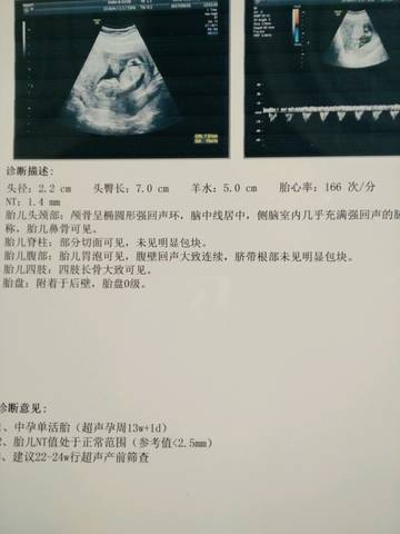 journal_insert_pic_848503751