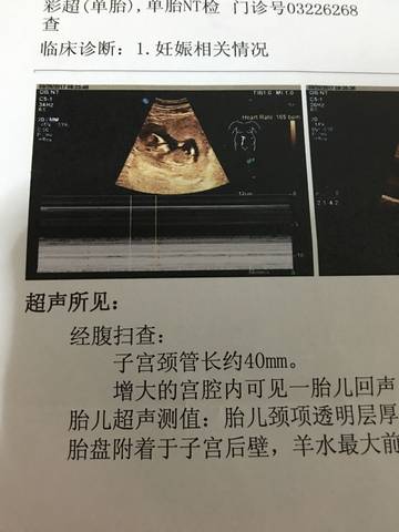 journal_insert_pic_849189061