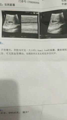 journal_insert_pic_850127997