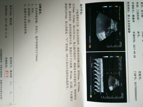 journal_insert_pic_855694067