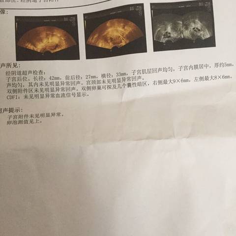 journal_insert_pic_856657689