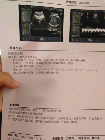 journal_insert_pic_857800994