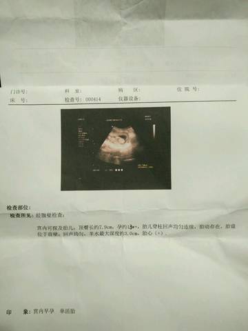 journal_insert_pic_860803844