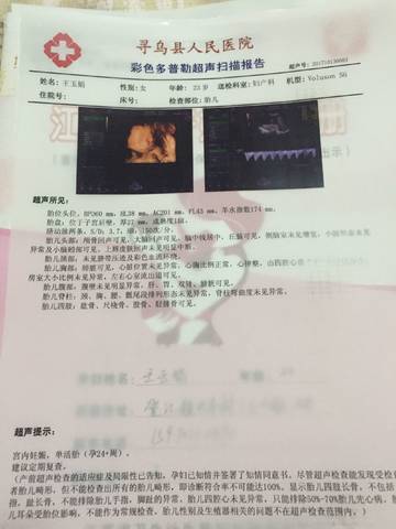 journal_insert_pic_862505736