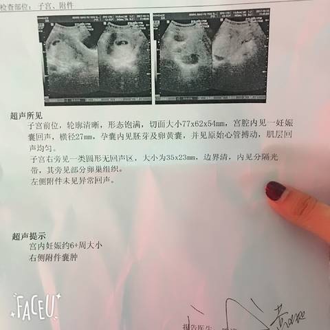 journal_insert_pic_862462747