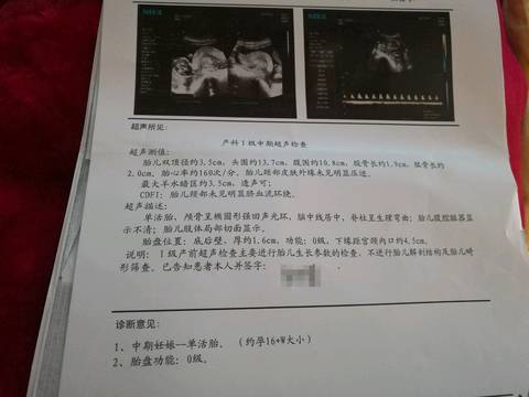 journal_insert_pic_863298459