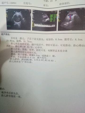 journal_insert_pic_866805256