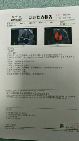 journal_insert_pic_869661244