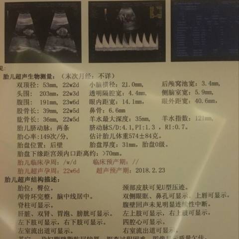 journal_insert_pic_870659741
