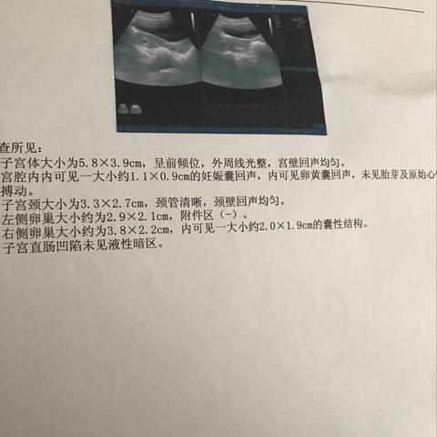 journal_insert_pic_870426901