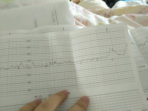 journal_insert_pic_872326133