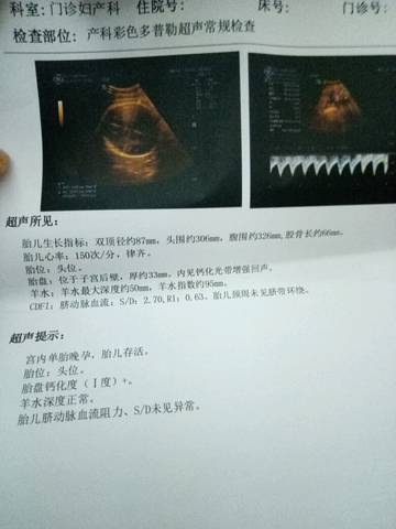 journal_insert_pic_873480345
