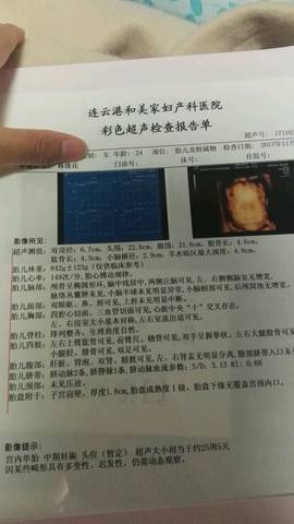 journal_insert_pic_877026075