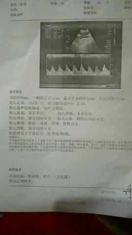 journal_insert_pic_876845279