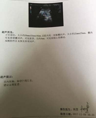 journal_insert_pic_877038094