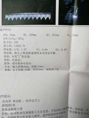 journal_insert_pic_878287720