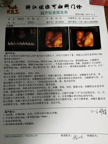 journal_insert_pic_879279173