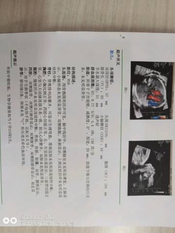 journal_insert_pic_879751459