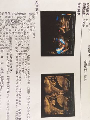 journal_insert_pic_882139480