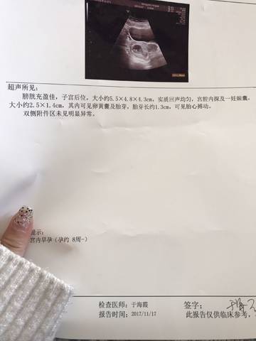 journal_insert_pic_885967094