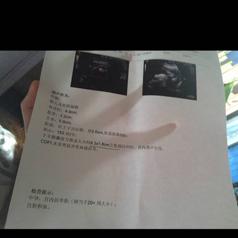 journal_insert_pic_888138588