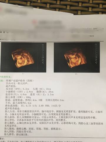journal_insert_pic_889222097