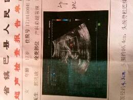 journal_insert_pic_890713067