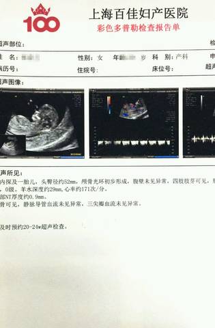 journal_insert_pic_894377015